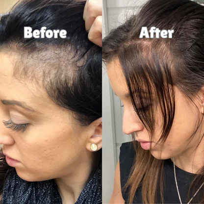 Ruvani Hair Growth Roll-on