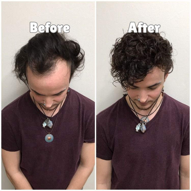 Ruvani Hair Growth Roll-on